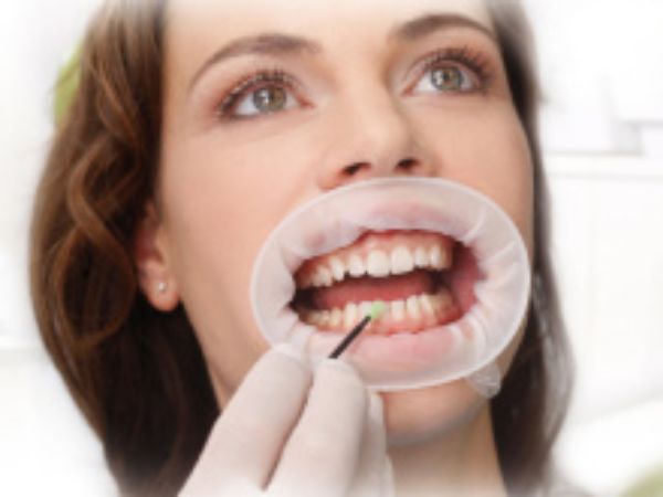 Vivadent Optragate ramme small 590851