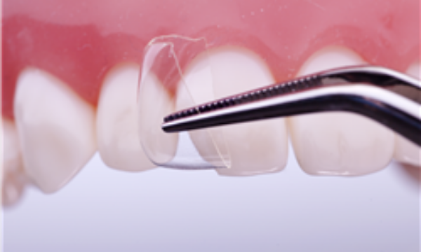 Directa CoForm 21 Mesial 604038