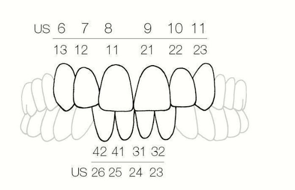 Directa CoForm 12 Mesial 604040