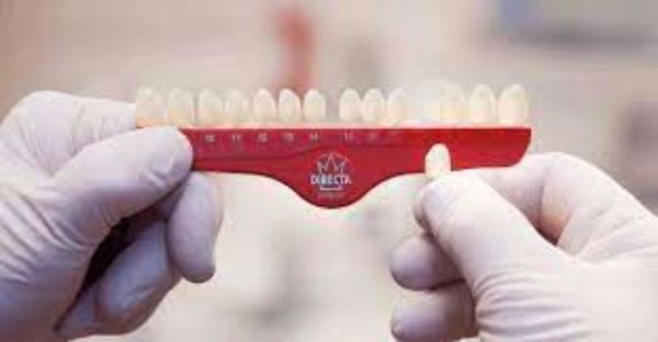 Directa plastkroner 27 