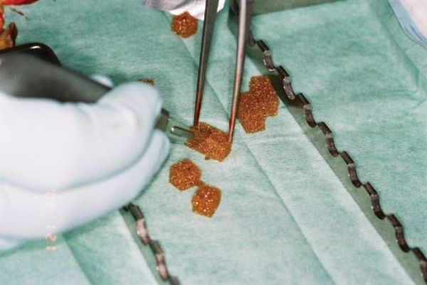 Roeko Gelatamp 274007, Gelatin-svamp 50stk