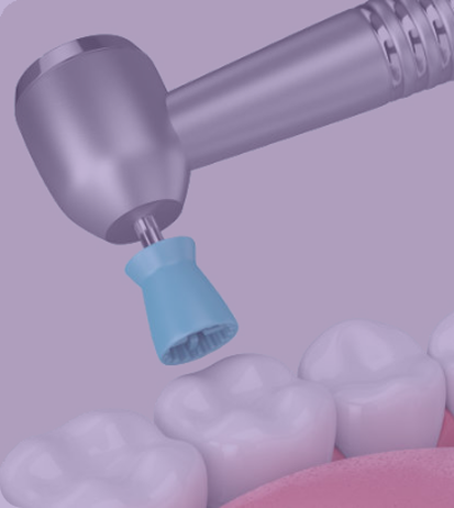 Polish dental puss og polering